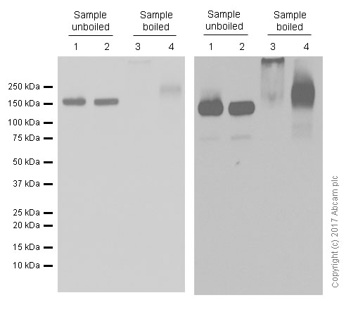 Western blot - Anti-P Glycoprotein antibody [EPR10364-57] (ab170904), expandable thumbnail