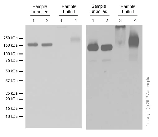Western blot - Anti-P Glycoprotein antibody [EPR10364-57] (AB170904)