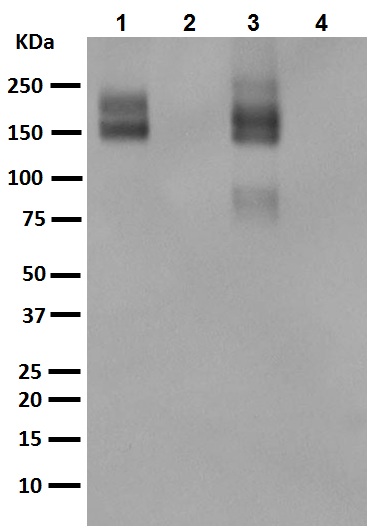 Western blot - Anti-P Glycoprotein antibody [EPR10364-57] (ab170904), expandable thumbnail