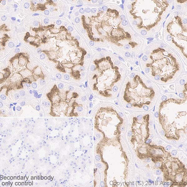 Immunohistochemistry (Formalin/PFA-fixed paraffin-embedded sections) - Anti-P Glycoprotein antibody [EPR10364-57] - BSA and Azide free (AB216656), expandable thumbnail