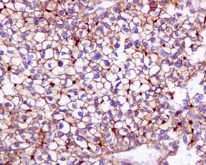 Immunohistochemistry (Formalin/PFA-fixed paraffin-embedded sections) - Anti-P Glycoprotein antibody [EPR10364-57] - BSA and Azide free (AB216656), expandable thumbnail