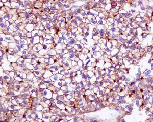 Immunohistochemistry (Formalin/PFA-fixed paraffin-embedded sections) - Anti-P Glycoprotein antibody [EPR10364-57] - BSA and Azide free (AB216656)