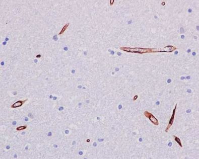 Immunohistochemistry (Formalin/PFA-fixed paraffin-embedded sections) - Anti-P Glycoprotein antibody [EPR10364-57] - BSA and Azide free (ab216656), expandable thumbnail