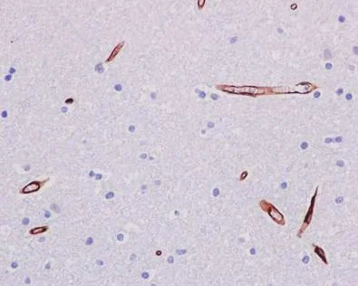 Immunohistochemistry (Formalin/PFA-fixed paraffin-embedded sections) - Anti-P Glycoprotein antibody [EPR10364-57] - BSA and Azide free (AB216656)