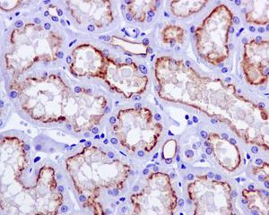 Immunohistochemistry (Formalin/PFA-fixed paraffin-embedded sections) - Anti-P Glycoprotein antibody [EPR10364-57] - BSA and Azide free (AB216656), expandable thumbnail