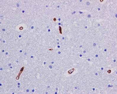 Immunohistochemistry (Formalin/PFA-fixed paraffin-embedded sections) - Anti-P Glycoprotein antibody [EPR10364-57] - BSA and Azide free (ab216656), expandable thumbnail