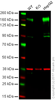 Western blot - Anti-P Glycoprotein antibody [EPR10364-57] - BSA and Azide free (AB216656), expandable thumbnail