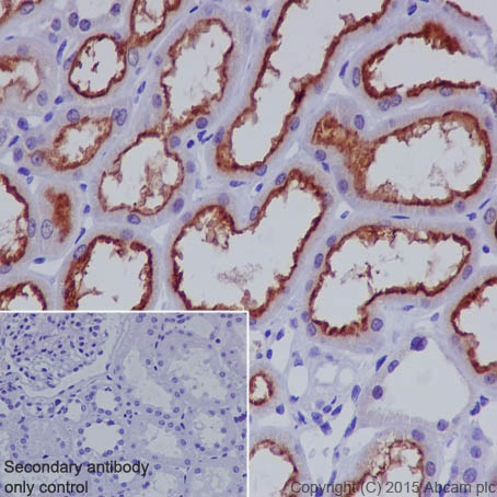 Immunohistochemistry (Formalin/PFA-fixed paraffin-embedded sections) - Anti-P Glycoprotein antibody [EPR10364] (AB168337), expandable thumbnail