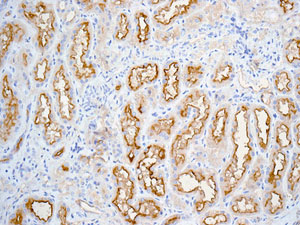 Immunohistochemistry (Formalin/PFA-fixed paraffin-embedded sections) - Anti-P Glycoprotein antibody [EPR10364] (ab168337), expandable thumbnail