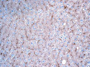 Immunohistochemistry (Formalin/PFA-fixed paraffin-embedded sections) - Anti-P Glycoprotein antibody [EPR10364] (ab168337), expandable thumbnail