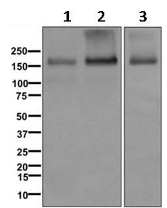 Western blot - Anti-P Glycoprotein antibody [EPR10364] (AB168337), expandable thumbnail