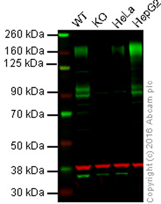 Western blot - Anti-P Glycoprotein antibody [EPR10364] (AB168337), expandable thumbnail
