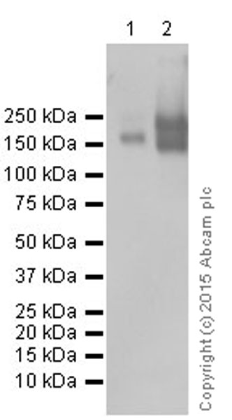 Western blot - Anti-P Glycoprotein antibody [EPR10364] (AB168337), expandable thumbnail