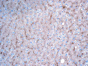 Immunohistochemistry (Formalin/PFA-fixed paraffin-embedded sections) - Anti-P Glycoprotein antibody [EPR10364] - BSA and Azide free (AB271921)