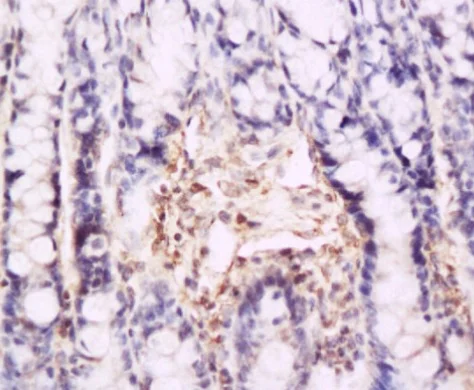Immunohistochemistry (Formalin/PFA-fixed paraffin-embedded sections) - Anti-P-Selectin (CD62P) antibody (AB202983)