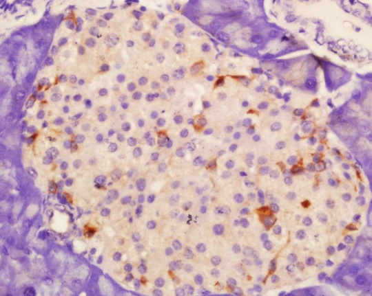 Immunohistochemistry (Formalin/PFA-fixed paraffin-embedded sections) - Anti-P-Selectin (CD62P) antibody (AB202983)
