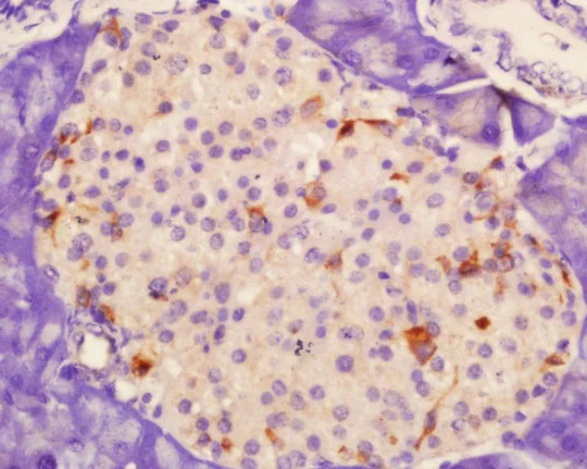Immunohistochemistry (Formalin/PFA-fixed paraffin-embedded sections) - Anti-P-Selectin (CD62P) antibody (AB202983)