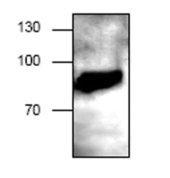 Western blot - Anti-P-Selectin (CD62P) antibody (AB59738)