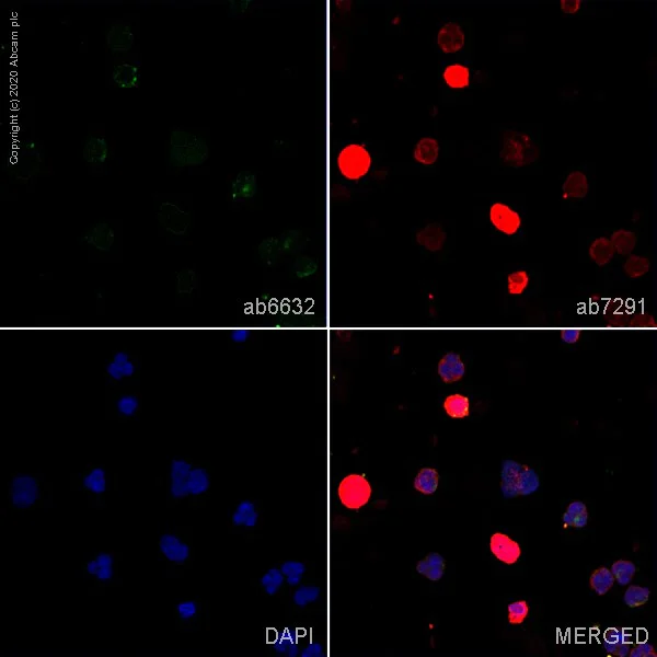Immunocytochemistry/ Immunofluorescence - Anti-P-Selectin (CD62P) antibody [AK-6] (AB6632)
