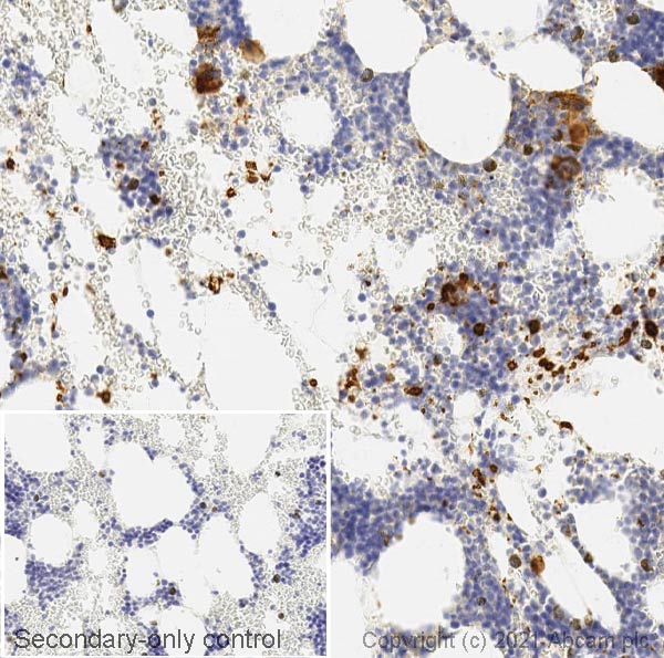 Immunohistochemistry (Formalin/PFA-fixed paraffin-embedded sections) - Anti-CD62P antibody [AK-6] (AB6632)