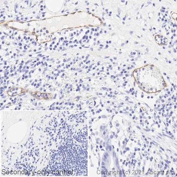 Immunohistochemistry (Formalin/PFA-fixed paraffin-embedded sections) - Anti-P-Selectin (CD62P) antibody [AK-6] (AB6632)