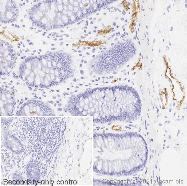 Immunohistochemistry (Frozen sections) - Anti-P-Selectin (CD62P) antibody [AK-6] (AB6632)