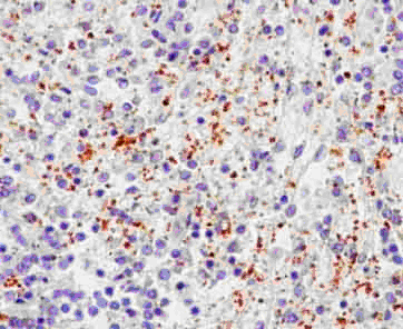 Immunohistochemistry (Formalin/PFA-fixed paraffin-embedded sections) - Anti-P-Selectin (CD62P) antibody [EPR2146(2)] (AB182135)