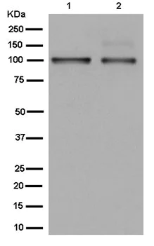 Western blot - Anti-P-Selectin (CD62P) antibody [EPR2146(2)] (AB182135)