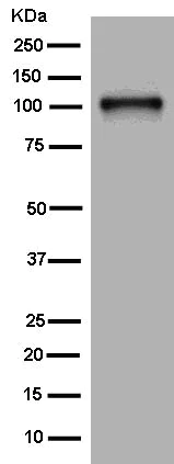 Western blot - Anti-P-Selectin (CD62P) antibody [EPR2146(2)] (AB182135)