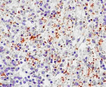 Immunohistochemistry (Formalin/PFA-fixed paraffin-embedded sections) - Anti-P-Selectin (CD62P) antibody [EPR2146(2)] - BSA and Azide free (AB250579)