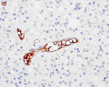 Immunohistochemistry (Formalin/PFA-fixed paraffin-embedded sections) - Anti-P-Selectin (CD62P) antibody [EPR2146(2)] - BSA and Azide free (AB250579)