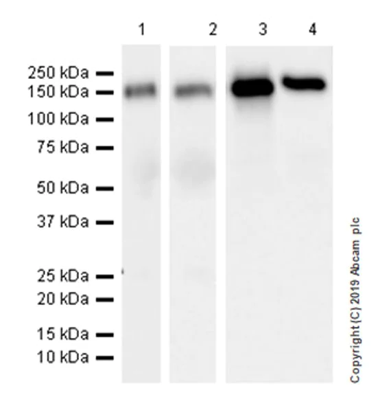 Western blot - Anti-P-Selectin (CD62P) antibody [EPR22850-190] (AB255822)