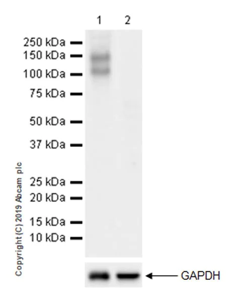 Western blot - Anti-P-Selectin (CD62P) antibody [EPR22850-190] (AB255822)
