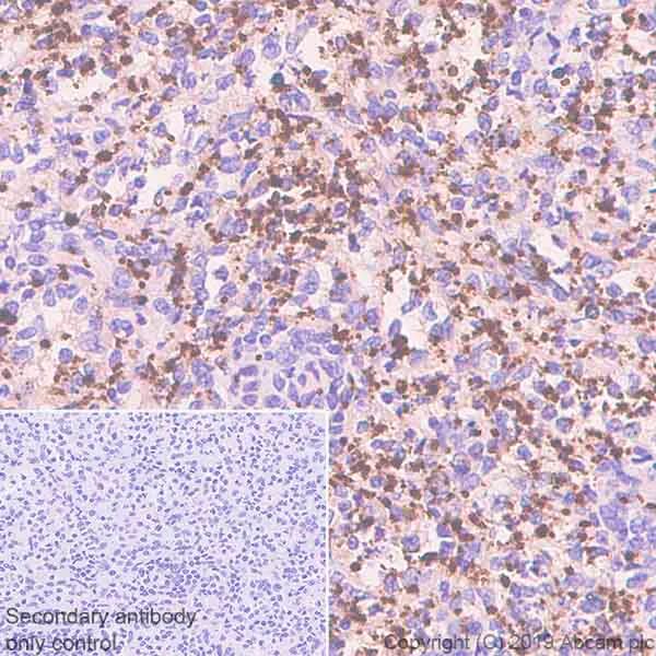 Immunohistochemistry (Formalin/PFA-fixed paraffin-embedded sections) - Anti-P-Selectin (CD62P) antibody [EPR22850-190] - BSA and Azide free (AB256823)