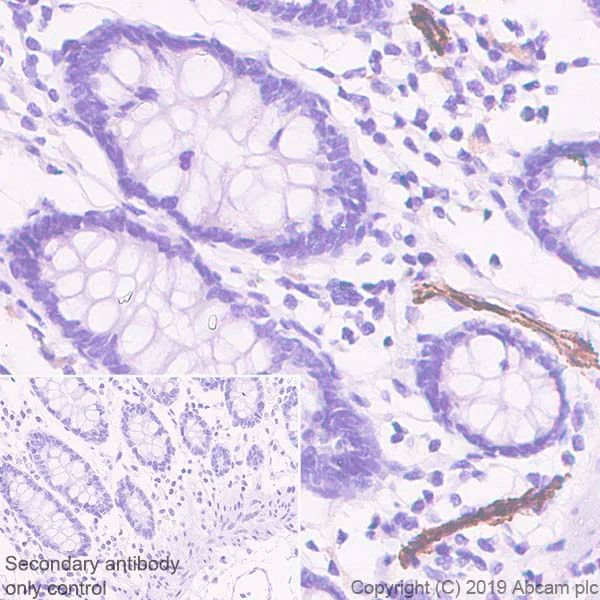 Immunohistochemistry (Formalin/PFA-fixed paraffin-embedded sections) - Anti-P-Selectin (CD62P) antibody [EPR22850-190] - BSA and Azide free (AB256823)
