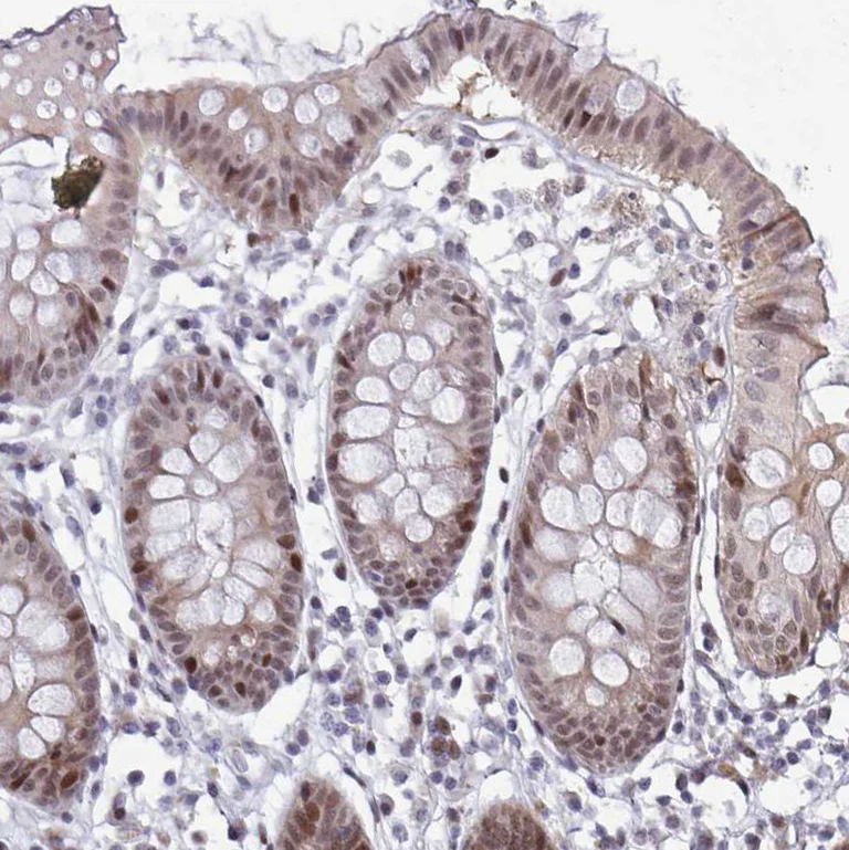 Immunohistochemistry (Formalin/PFA-fixed paraffin-embedded sections) - Anti-p107 antibody (AB244504)