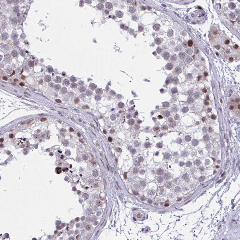 Immunohistochemistry (Formalin/PFA-fixed paraffin-embedded sections) - Anti-p107 antibody (AB244504)