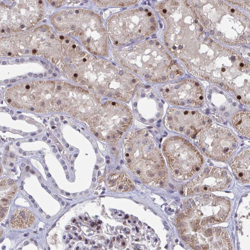 Immunohistochemistry (Formalin/PFA-fixed paraffin-embedded sections) - Anti-p107 antibody (AB244504)