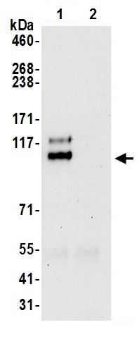 Immunoprecipitation - Anti-p107 antibody (AB245514), expandable thumbnail