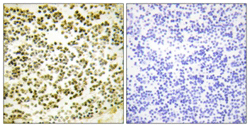 Immunohistochemistry (Formalin/PFA-fixed paraffin-embedded sections) - Anti-p107 (phospho T369) antibody (AB111348), expandable thumbnail