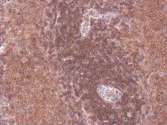 Immunohistochemistry (Formalin/PFA-fixed paraffin-embedded sections) - Anti-p114RhoGEF antibody (AB96520)