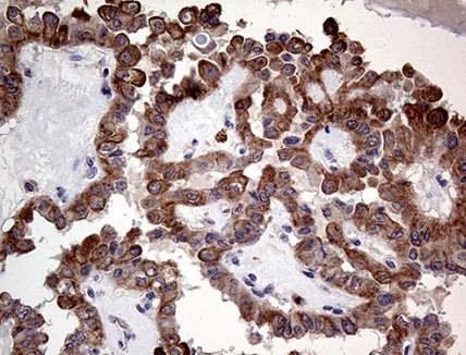 Immunohistochemistry (Formalin/PFA-fixed paraffin-embedded sections) - Anti-p114RhoGEF antibody [OTI6D10] (AB236374)