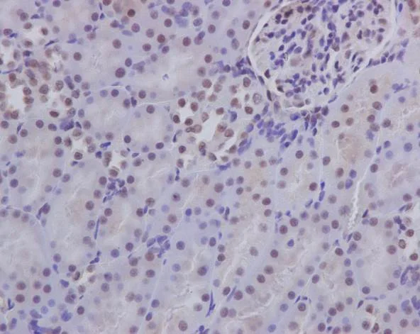 Immunohistochemistry (Formalin/PFA-fixed paraffin-embedded sections) - Anti-p130 antibody [EP2141Y] (AB76234)