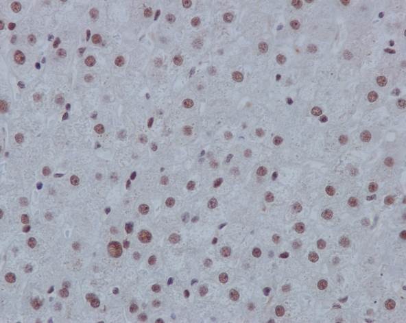 Immunohistochemistry (Formalin/PFA-fixed paraffin-embedded sections) - Anti-p130 antibody [EP2141Y] (AB76234)