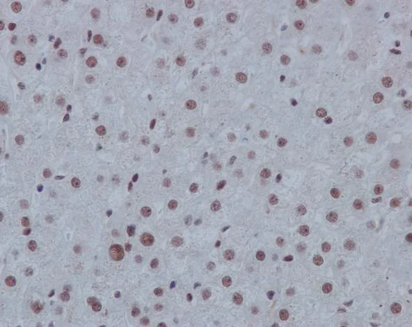 Immunohistochemistry (Formalin/PFA-fixed paraffin-embedded sections) - Anti-p130 antibody [EP2141Y] (AB76234)