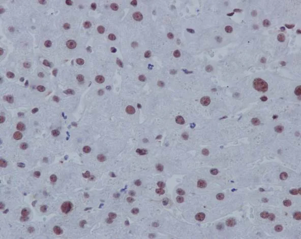 Immunohistochemistry (Formalin/PFA-fixed paraffin-embedded sections) - Anti-p130 antibody [EP2141Y] (AB76234)