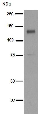Western blot - Anti-p130 antibody [EP2141Y] (AB76234)