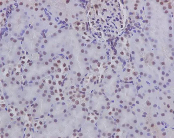 Immunohistochemistry (Formalin/PFA-fixed paraffin-embedded sections) - Anti-p130 antibody [EP2141Y] - BSA and Azide free (AB247453)
