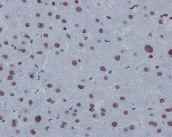 Immunohistochemistry (Formalin/PFA-fixed paraffin-embedded sections) - Anti-p130 antibody [EP2141Y] - BSA and Azide free (AB247453)
