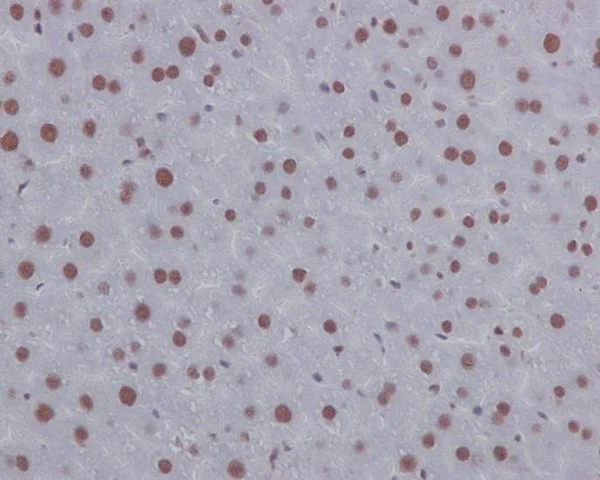 Immunohistochemistry (Formalin/PFA-fixed paraffin-embedded sections) - Anti-p130 antibody [EP2141Y] - BSA and Azide free (AB247453)